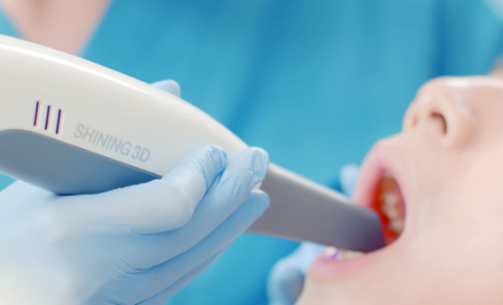 デジタル印象採得装置(Aoralscan3) 精密な歯型の採得が可能